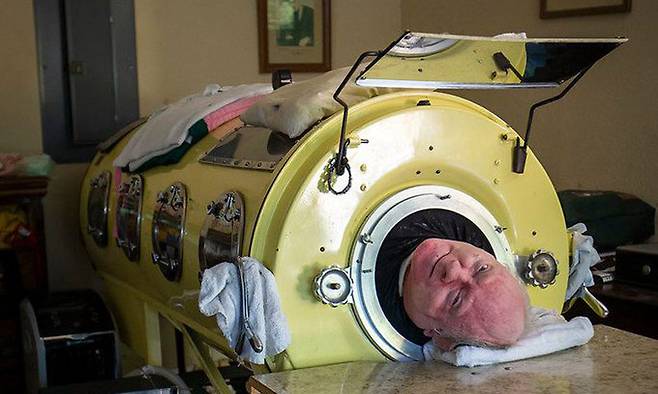 여섯 살 때 소아마비를 앓은 후 여전히 강철폐에 의존해서 사는 폴 알렉산더.