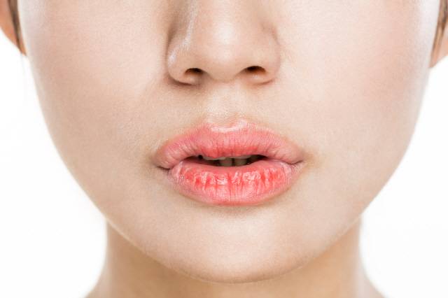피부과 전문의들은 손으로 무리하게 입술 각질을 뜯지 말라고 한다./클립아트코리아 제공