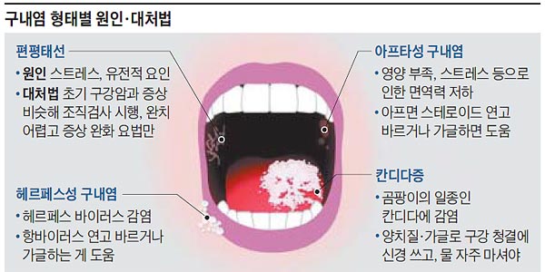 조선일보 DB