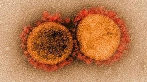 코로나19 바이러스 전자현미경 이미지 [사진=미국 국립 알레르기 감염병 연구소(NIAID)]