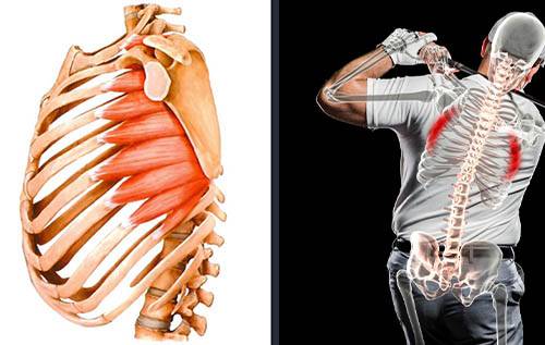 전거근(왼쪽)과 늑골골절. [출처=최인호 저 '스윙메카닉스를 이용한 골프손상의 이해']
