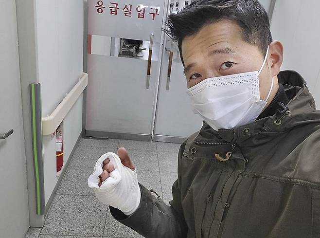 강형욱 동물훈련사가 지난 4일 자신의 개에 물렸다고 사고 소식을 전했다. [인스타그램 캡처]