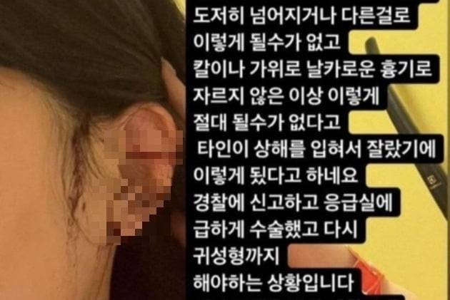 귀 절단 당사자인 A씨는 클럽 내부에서 상해를 입었을 것이라는 취지의 주장을 하고 있다. / 사진=온라인 커뮤니티