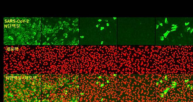 라이코린 처리로 SARS-CoV-2 N단백질(녹색)의 세포 내 발현이 농도의존적으로 억제됨을 공초점 현미경으로 확인했다.[한국한의학연구원 제공]