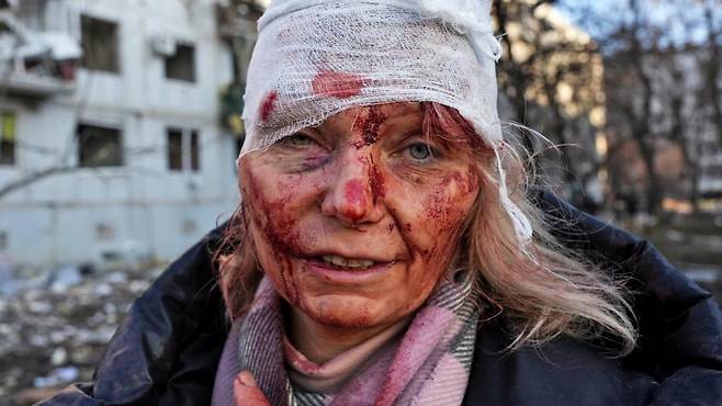 러시아 미사일 공격에서 생존한 우크라이나 교사 올레나 쿠릴로씨 [WOLFGANG SCHWAN/ANADOLU AGENCY/게티 이미지. 재판매 및 DB  금지]