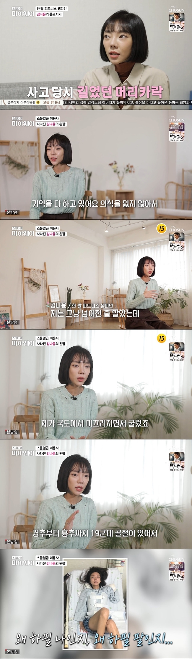 Fitness player Kim Na Yoon has commented on past AcidentsOn March 20th, TV Chosun Star Documentary My Way, a arm fitness player Kim Na Yoon daily was revealed.Kim Na Yoon, who worked as a hair designer before the accident, said: I started in beauty when I was 17. I lived thinking of work as a top priority.At 27, 2018, the accident happened: I remember everything because I didnt lose my memory at the time of the accident. It was the first time the heatwave started. It was hot and hot.I paid a monthly rent to the company and left for Chuncheon with a light heart because I was not long on vacation or vacation due to the nature of my job, and I left for Chuncheon.I was going and I slipped on the national highway and rolled, he recalled.I thought I just fell, but I could not get up. My friend came and cried because I had no arms. I wanted to hear it wrong.I touched this side and felt like I had no real arms and I did not move.His arm was amputated and flew away, and 19 places from the cervical vertebrae to the thoracic vertebrae were fractures, so he couldnt get up.I asked my friend to find my arm because I could not get enough rotting to join, and a friend came to me. I went to the emergency room in the vicinity. I was told that there was a difficulty in operating because my arm was too damaged, but I was able to do it because of sepsis.For a hairdresser, the left hand is a very important role: most of the time, the pilot and angle are controlled by the left hand, and my goals, dreams, and all that I have done have been lost.I cried a lot. If the transportation wasnt motorcycle, I wondered if it was an accident, whose fault it was, why it had happened to me.I didnt think it would be the right answer to not think about it. If Id been grateful, Id have died instantly.I was right-handed, but my left arm was cut off, so I was grateful. 