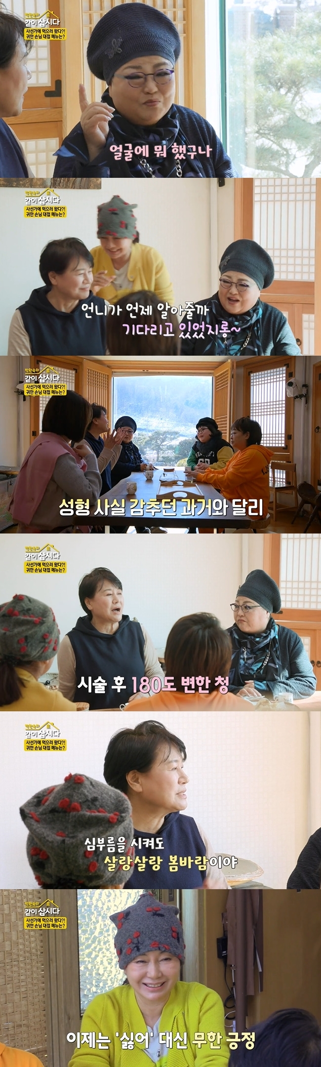 Kim Chung was satisfied with his changed face after the procedure.In KBS 2TV Lets Live With Park Won-sook Season 3 broadcast on March 30, Yoon Hee-jung was surprised at Kim Chungs changed face.When a sage surprised Yoon Hee-jung and Kim Soo-yeons mother and daughters faces, she said, We are a lifetime life, and said, We did not touch our faces at all.At that time, Yoon Hee-jung looked at Kim Chungs face, which introduced the menu to be served, and was surprised to see, Why is his face so tight?Kim Chung said, I was a child-sucker, and said, I was waiting for my sister to know when.Kim Chung confessed earlier that he had been laser-treated for wrinkles when Lee visited the house. Park Won-sook said, I used to hide the molding.He said, I did this, I did that. Yoon said, I was tight and pretty.When Kim Chung brought out his old fries, Park Won-sook said, Yesterday, I see that he is satisfied after the procedure.I think I will be still even if I hit it now. 