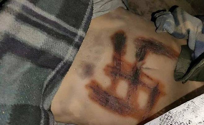 지난 4일(현지 시각) 우크라이나 하원의원이 트위터를 통해 러시아군이 고문 후 강간 살해한 것으로 추정되는 우크라이나 여성의 시신 사진을 공개했다. 여성의 배 부분에 나치 문양이 칼로 새겨져 있다. /트위터