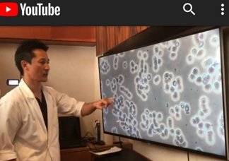 접지 전 적혈구의 엉겨 붙은 모습.