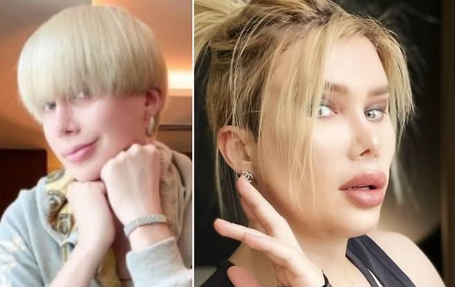 방탄소년단 멤버 지민을 닮고 싶어 약 20차례 성형수술을 한 올리 런던(왼쪽). 최근엔 한국인 여성이 되기 위해 성형수술을 받은 근황(오른쪽)을 전했다. [미러·올리런던 SNS 캡처]