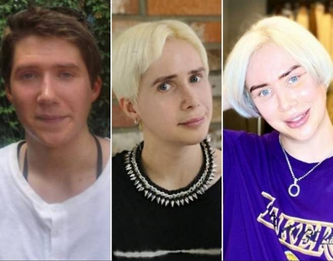 올리 런던의 성형전 2012년 모습(왼쪽), 가운데 사진은 2019년, 오른쪽은 2021년 6월 모습. [올리런던 인스타그램 캡처]