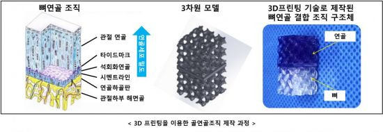 3D 프린팅을 이용한 골연골조직 제작 과정.