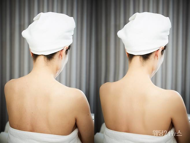 사진 : 스파 트리츠(TREATZ), (좌)before (우)after