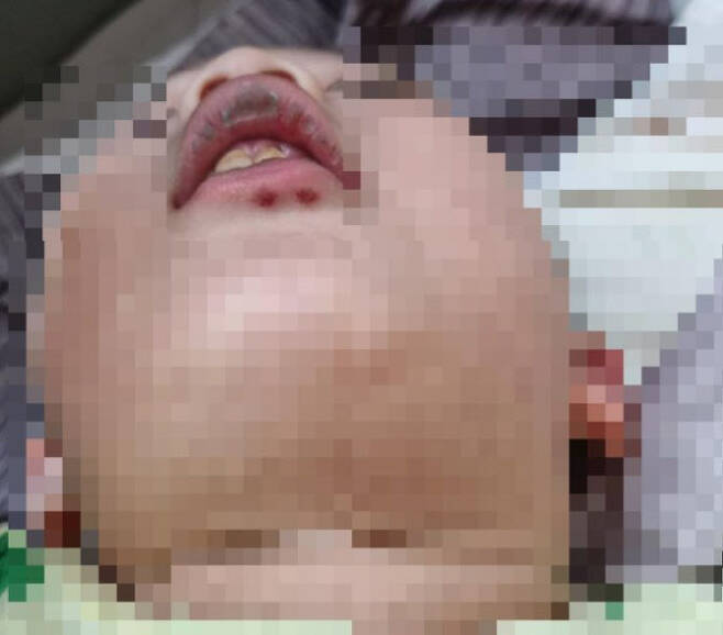 지난달 13일 서울 서대문구 한 어린이집에서 2살 아이가 다쳐 피를 흘리고 있음에도 교사들이 아무런 응급조치를 하지 않았다. (사진=온라인 커뮤니티 보배드림)