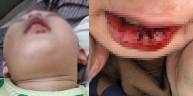 해당 아동의 모습  / 사진 = 온라인 커뮤니티 캡처