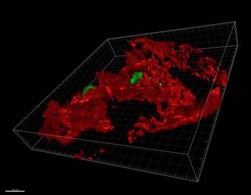 생쥐의 뼈에 전이한 유방암 세포  뼈 조직에 전이한 ZEB 1 발현 유방암 세포(녹색)의 3D 이미지.
ZEB 1 단백질은 암세포의 환경 적응 능력을 제어하며, 암세포가 전이 방향을 결정하는 데 영향을 미친다.
[스위스 제네바 의대 디디어 피카르트 교수 제공. 재판매 및 DB 금지]