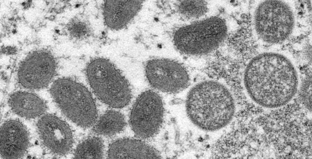 현미경으로 관찰한 원숭이두창 바이러스. 미국 질병통제예방센터(CDC)