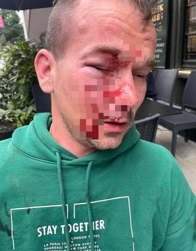 지난 18일 영국 런던 빅토리아역 인근에서 폴란드 이민자인 카밀 소발라(31)가 남성들에게 폭행을 당했다./사진=트위터