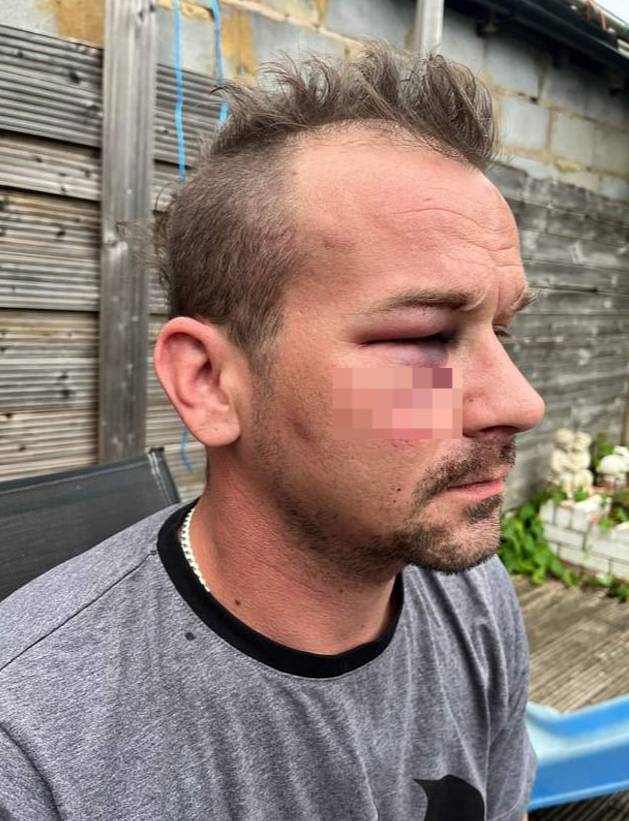 지난 18일 영국 런던 빅토리아역 인근에서 폴란드 이민자인 카밀 소발라(31)가 남성들에게 폭행을 당했다./사진=트위터