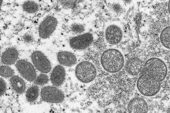 미국 질병통제예방센터(CDC)가 공개한 원숭이두창 바이러스 모습. AP연합뉴스
