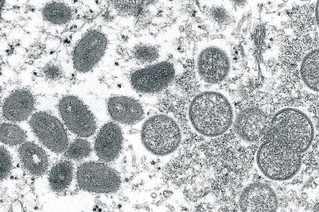 미국 질병통제예방센터(DCD)가 2003년 전자현미경으로 촬한 타원형의 원숭이두창 바이러스 입자(왼쪽)와 구형의 미성숙 바이러스 입자(오른쪽)ⓒAP 연합