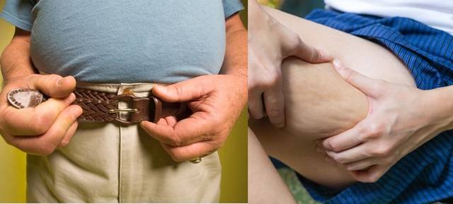효소와 호르몬 작용으로 남성과 여성 각각 살찌는 부위가 다르다/ 사진=게티이미지뱅크
