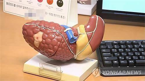 간경화 위험요인인 지방간 [연합뉴스TV 캡처] 작성 김선영(미디어 랩)