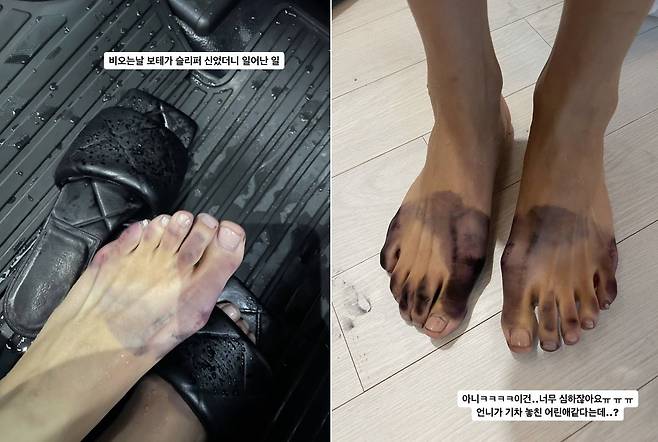 이가흔이 지난 30일 명품 슬리퍼로 인해 검게 물든 발을 공개했다. /인스타그램