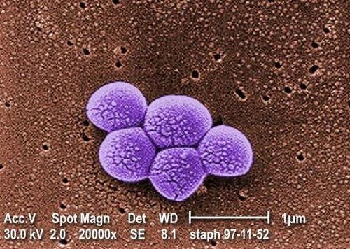 MRSA 다제내성균 MRSA(메티실린 내성 황색포도상구균)를 2만 배 확대한 전자현미경 이미지.
[미 질병통제예방센터(CDC) 홈페이지 캡처. 재판매 및 DB 금지]