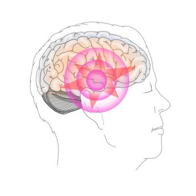 외상후 스트레스 장애(PTSD) [출처: 삼성서울병원]