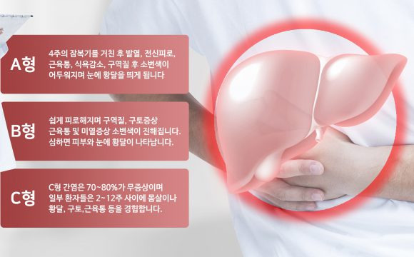 간염은 증상이 없어도 정기 검사가 필요하다. [사진=클립아트코리아]