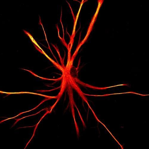 인간 유도만능줄기세포(iPSCs)에서 유래한 성상교세포  [뉴욕 줄기세포 재단 연구소 제공. 재판매 및 DB 금지]