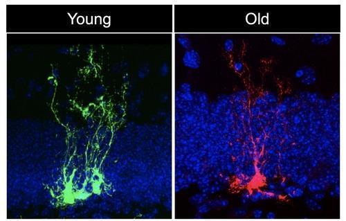 어린 생쥐와 늙은 생쥐의 신경줄기세포 [미국 서던캘리포니아대 Bonaguidi Lab. 재판매 및 DB 금지]