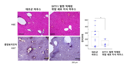 SYT11 발현이 억제된 줄기성 위암 세포를 이식한 마우스에서 간으로 전이 억제. 사진=한국생명공학연구원 제공