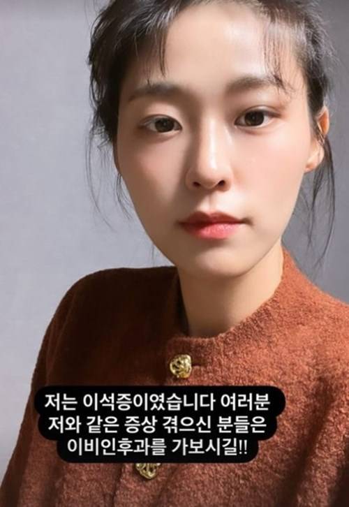 설현 이석증 고백 사진=설현 SNS