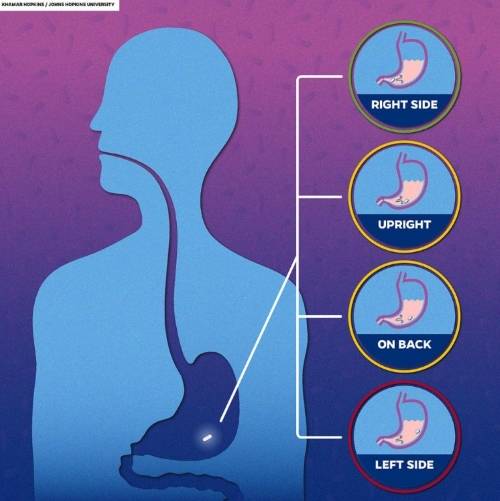 누워서 몸을 오른쪽으로 기울일 때 알약의 흡수가 가장 빠르다. 사진제공=존스홉킨스대학