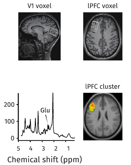 자기공명분광법으로 정신노동의 강도에 따른 뇌의 대사물질 농도 변화를 분석한 결과 인지 활동에 관여하는 측면 전전두피질(lPFC)에서 글루타메이트(Glu) 농도와 확산에서 차이가 났다. 반면 시각피질(V1)에서는 차이가 없었다. 커런트 바이올로지 제공 