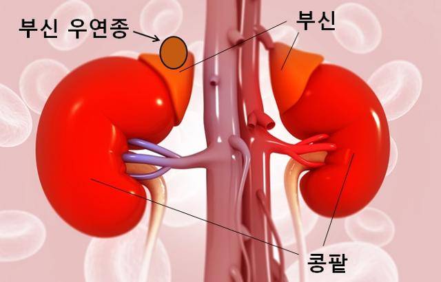 부신우연종.