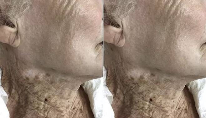 Journal of the European Academy of Dermatology and Venereology