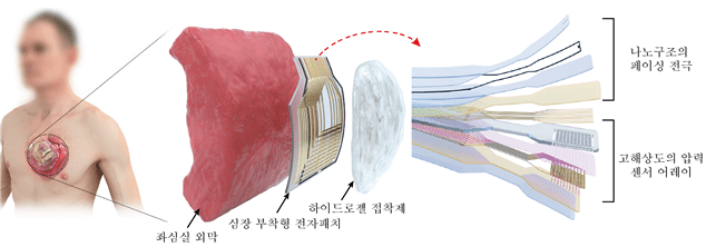 심장 부착형 패치형 디바이스 플랫폼 설계 (자료=IBS)