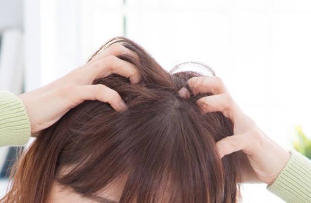 머리가 간지러우면 자연스럽게 손톱을 세워 두피를 긁게 된다. 이 습관이 탈모를 유발할 수도 있다./사진=클립아트코리아