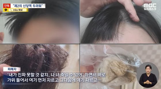 이별을 통보한 연인을 집에 감금하고 5시간 동안 무차별 폭행한 20대 남성이 불구속 상태로 재판에 넘겨졌다. 사진은 폭행 당한 여성의 모습. MBC 영상 캡처