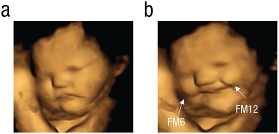 당근을 섭취한 임신부 집단의 태아들(b)에게서 아무것도 섭취하지 않은 임신부 집단의 태아들(a)보다 올라간 입꼬리가 관찰됐다. 사이컬러지컬 사이언스 저널 캡처