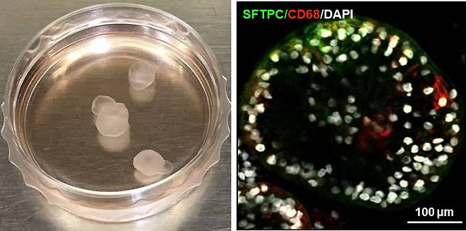 인간 전분화능 줄기세포 유래 3D 폐 오가노이드 이미지