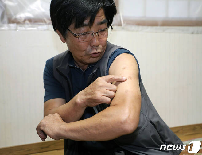 류관열씨가 자신의 왼쪽 팔에 남은 총알 흉터를 보여주고 있다. 2022.10.1/뉴스1