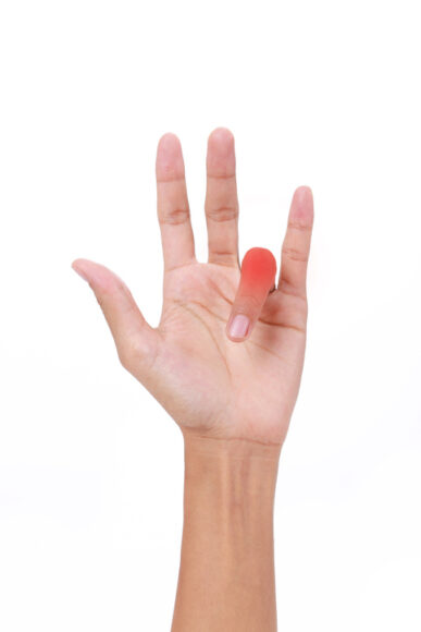 당뇨병 환자는 앞으로 손가락이 구부러지는 '방아쇠 손가락'에도 각별히 관심을 가져야 할 것 같다. 당화혈색소가 높은 당뇨 환자가 이 병에 걸릴 위험이 매우 높기 때문이다.[사진=게티이미지뱅크]