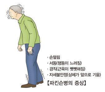 파킨슨병 [출처: 서울아산병원]