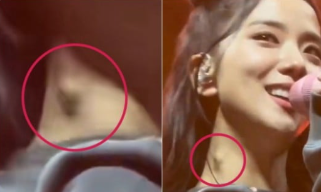 블랙핑크 멤버인 지수의 목에 눈에 띄는 혹이 생겼다. [사진=온라인 커뮤니티]