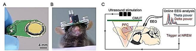 [대전=뉴시스] A는 KAIST 공동연구팀이 개발한 MEMS 기반 초소형 초음파 소자고 B는 자유롭게 움직이는 쥐 머리 위에 접목된 초음파 소자와 뇌파 전극이다. C는 실시간 초음파 자극 및 뇌파 측정이 가능한 폐루프 시스템의 모식도. *재판매 및 DB 금지
