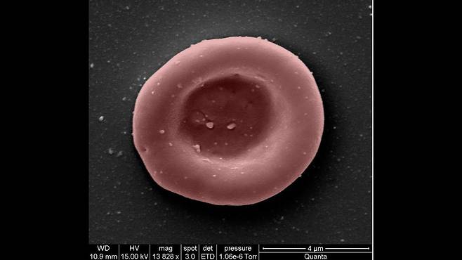 혈액 줄기세포로 만든 적혈구. 양쪽이 오목하고 내부에 산소와 결합하는 헤모글로빈이 들어 있다./NHSBT